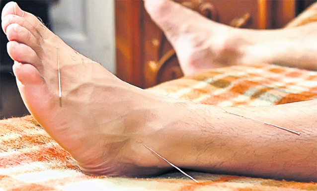 Marian Drăgulescu a apelat la acupunctură pentru a-şi rezolva problemele medicale, înaintea Olimpiadei