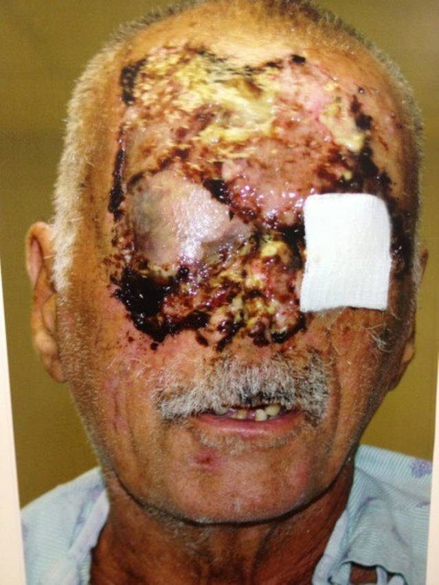 Prima imagine cu victima canibalului din Miami