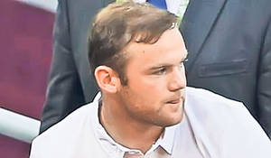 «Monstrul» blând! Când avea 5 ani, Joleon Lescott a fost accidentat de o maşină, operaţiile nenorocit-i chipul