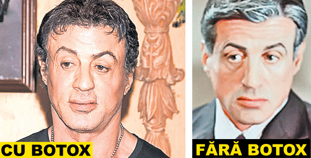 Zici că-s împăiați! Staruri de la Hollywood și politicienii celebri și-au distrus fețele cu prea mult botox