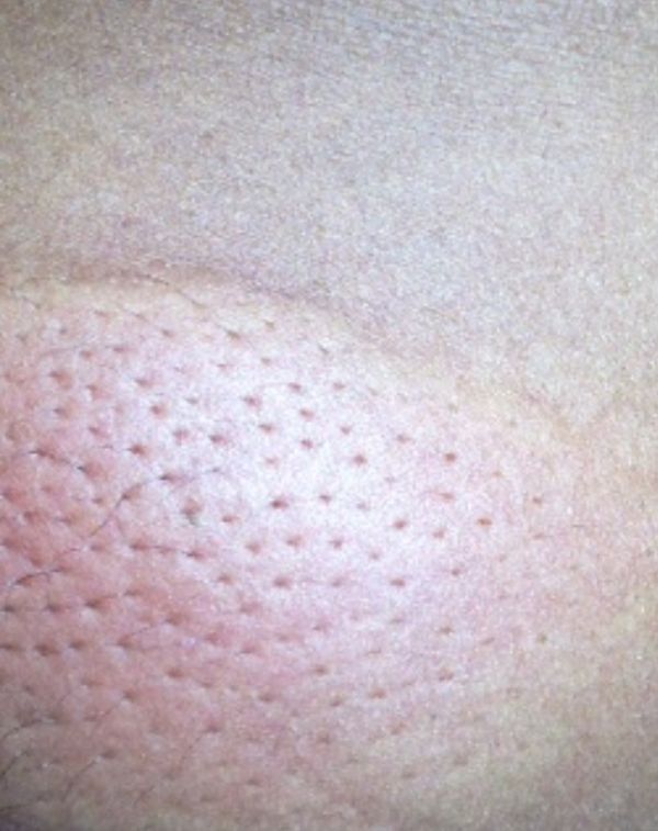 Așa arată burla lui Cabral