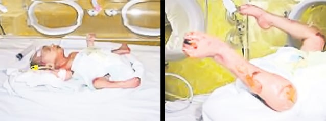 Micuţa aceasta a supravieţuit focului de la Maternitatea Giuleşti | EXCLUSIV