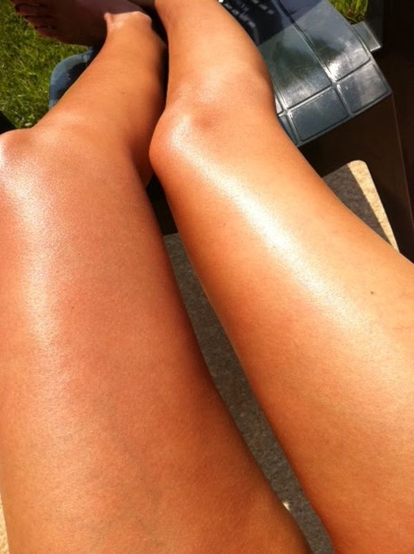 S-a lăsat înțepată degeaba! Ioana Ginghină nu a scăpat de celulită. Uite cum arată picioarele ei!