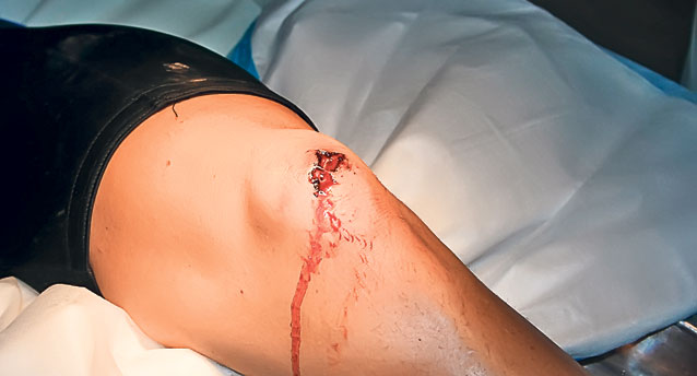 Dacă rănile erau superficiale, de ce a fost operat Adrian Năstase? 