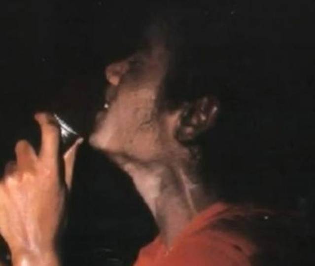 Michael Jackson, una dintre imaginile care arată că avea vitiligo