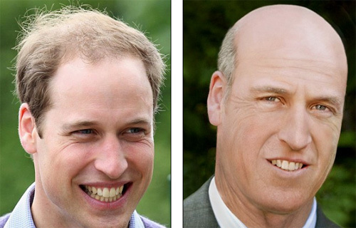 Cea mai ȘOCANTĂ imagine a lui Kate Middleton: riduri în jurul gurii și dinți galbeni