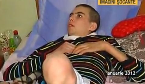 IMAGINI ŞOCANTE Cum arată acum ROMÂNUL distrus de DROGUL-CROCODIL. Mama: "Uneori, are minte de 2 ani"