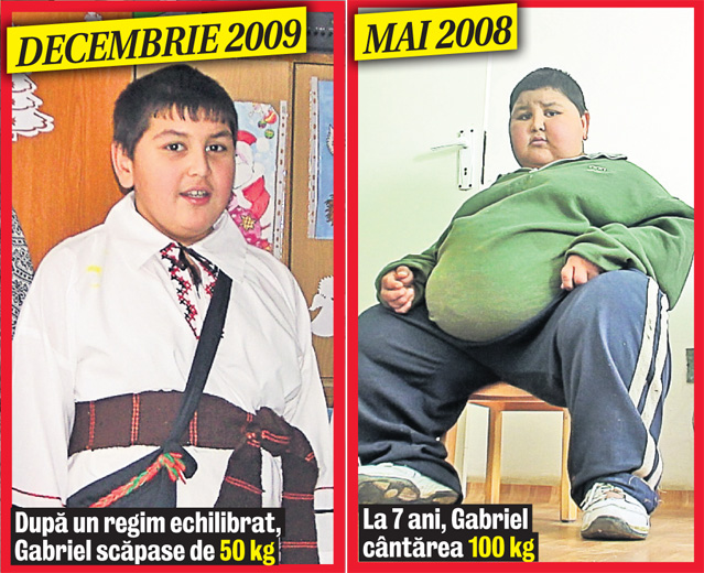 Puştiul din Botoşani care la 7 ani ajunsese la 100 de kilograme a recidivat din cauza mamei sale