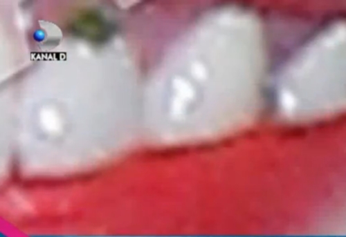 PĂSĂRICI LA VEDERE, MÂNCARE ÎNTRE DINŢI SAU PIELE NEEPILATĂ! Uite care sunt CELE MAI PENIBILE GAFE, pe care le-au făcut vedetele de top de la noi, în 2012 | FOTO