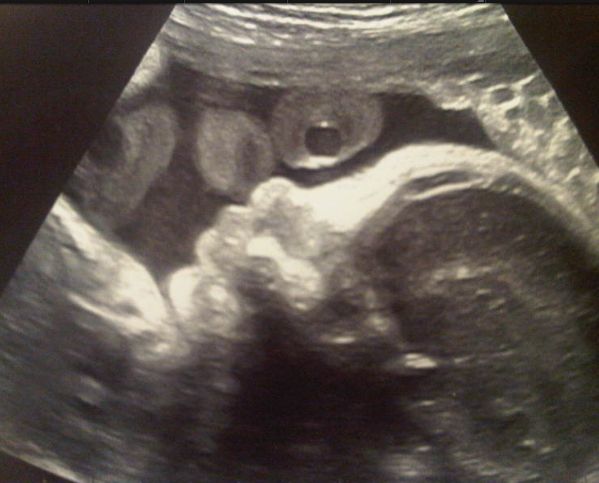 EMOȚIONANT! Shakira a făcut publică prima fotografie cu copilul ei