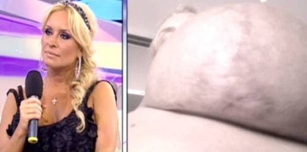 Vedete de la noi, DESFIGURATE de intervențiile chirugicale în 2012