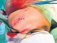 Situaţie dramatică în familia stelistului Pârvulescu, accidentat grav. Ana, soţia lui Paul, e încă şocată: «Nasc miercuri, n-am cum să merg la el la spital»