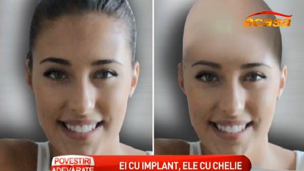 Domnii își fac implant, iar la doamne se poartă chelia? Vezi cum ar arăta Inna, Antonia și Corina dacă ar accepta să se TUNDĂ ZERO! FOTO&VIDEO