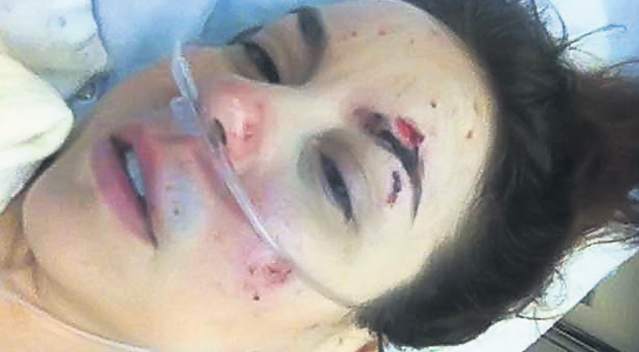 Româncă desfigurată de un poliţist în Canada | Atenție, imagini șocante
