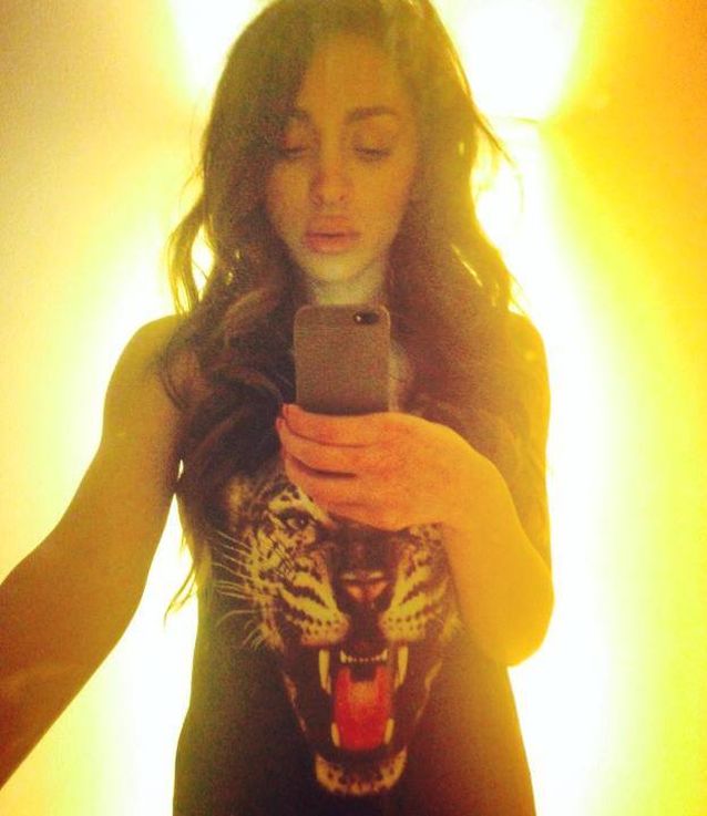 Şi-a injectat acid hialuronic în buze? Ruby şi-a şocat fanii! Uite cum arată! FOTO