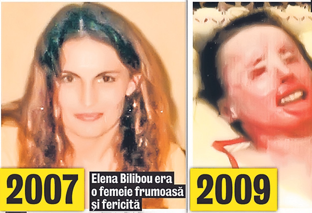 De cinci ani e desfigurată, vinovatul e liber! Poliţiştii nu au dat nici până acum de urma celui care a nenorocit-o pe femeia din Suceava