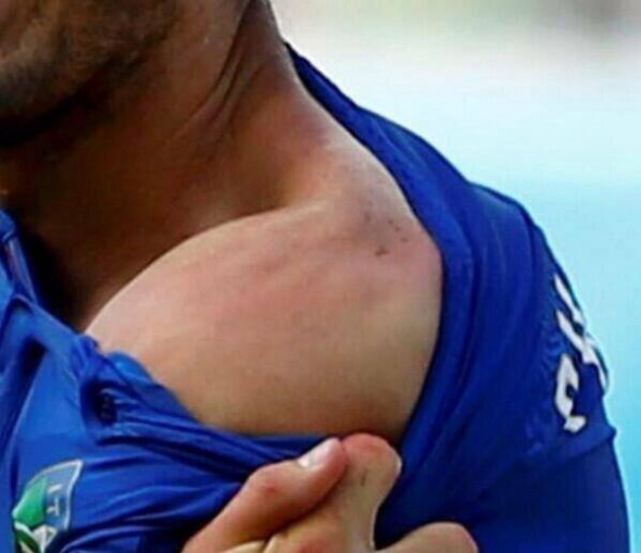 Chiellini