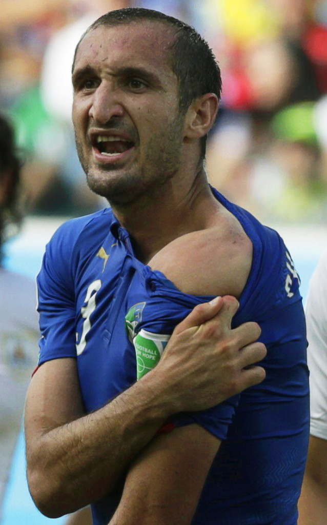 CHIELLINI