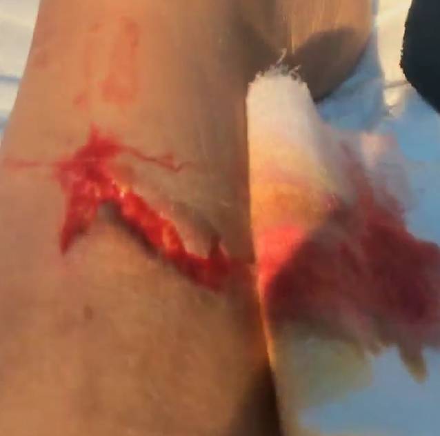 ATENŢIE, IMAGINI ŞOCANTE! BIANCA DRĂGUŞANU A AJUNS DE URGENŢĂ LA SPITAL! Ce i s-a întâmplat ROŞCATEI!