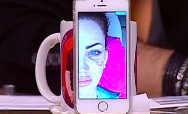Bianca Drăguşanu, desfigurată după un accident! FOTO
