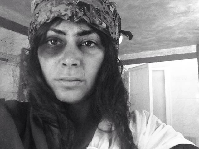 KITTY CEPRAGA, cu OCHIUL VÂNĂT şi PLÂNSĂ TOATĂ! Ce i s-a întâmplat frumoasei blonde?