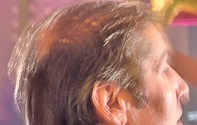 Ce vrăji a mai făcut bisturiul esteticianului