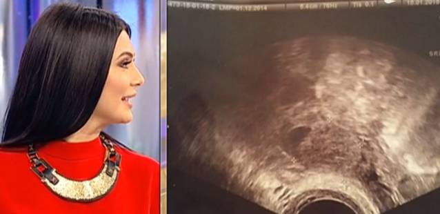 Cum a aflat Florin Salam că iubita lui este însărcinată? Manelistul a arătat prima ecografie a bebelușului | FOTO