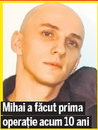 Sunt celebru, mai vreau păr | Mihai Trăistariu s-a programat deja la al patrulea implant | EXCLUSIV