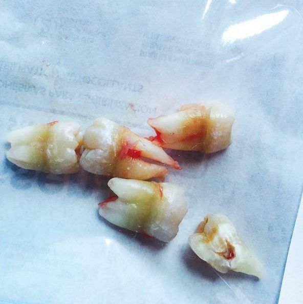 Cea MAI SCÂRBOASĂ POZĂ pe care a postat-o vreodată MILEY CYRUS pe INSTAGRAM! E mult SÂNGE și...