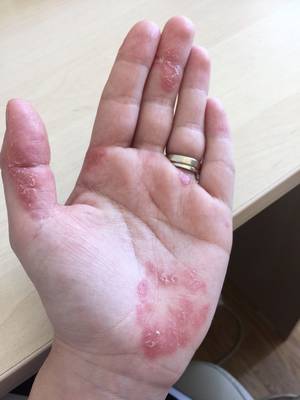 Tili Niculae are o boală fără leac: "Nu cred că o să mai treacă vreodată"